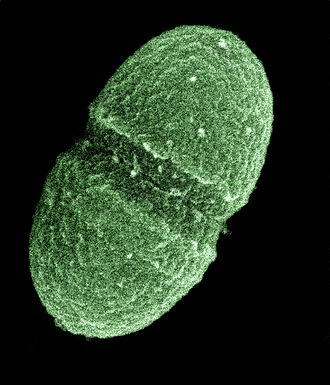 (PHOTO: Yuck!: “Enterococcus Faecalis”.)