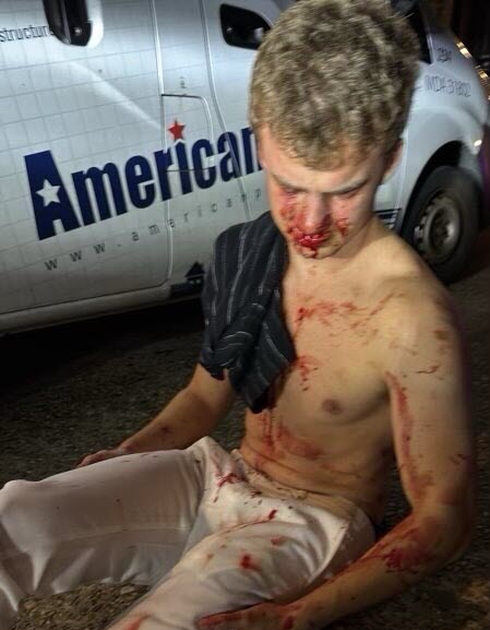 (PHOTO: President Donald Trump posted this photo of Edward "Big Balls" Coristine, the Rye Country Day School ’24 graduate and Department of Government Efficiency (DOGE) team member, after he was assaulted early Sunday, August 3, 2025 in a carjacking attempt. Source: Truth Social.)