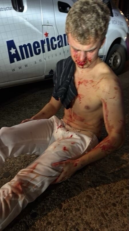 (PHOTO: President Donald Trump posted this photo of Edward "Big Balls" Coristine, the Rye Country Day School ’24 graduate and Department of Government Efficiency (DOGE) team member, after he was assaulted early Sunday, August 3, 2025 in a carjacking attempt. Source: Truth Social.)